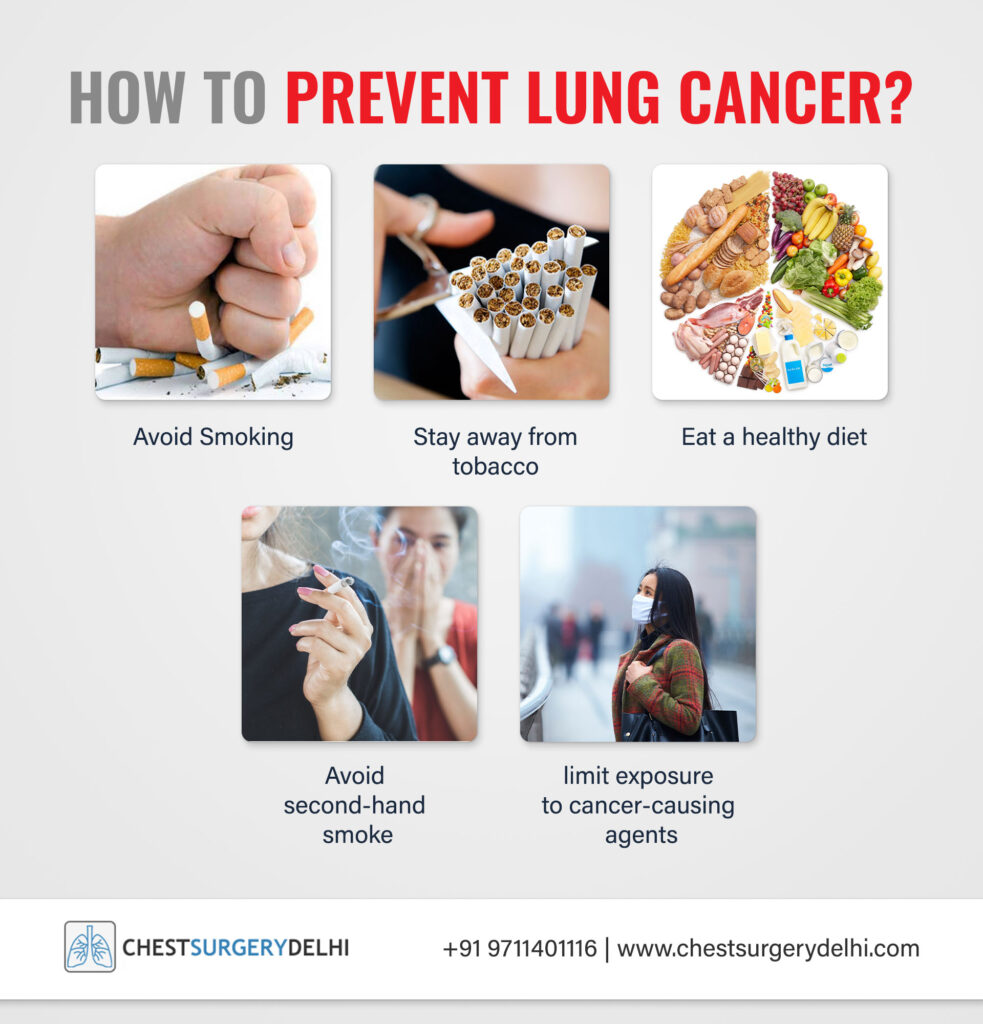 What is Lung Cancer