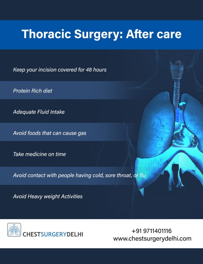 Everything You Need To Know About Thoracic Surgery